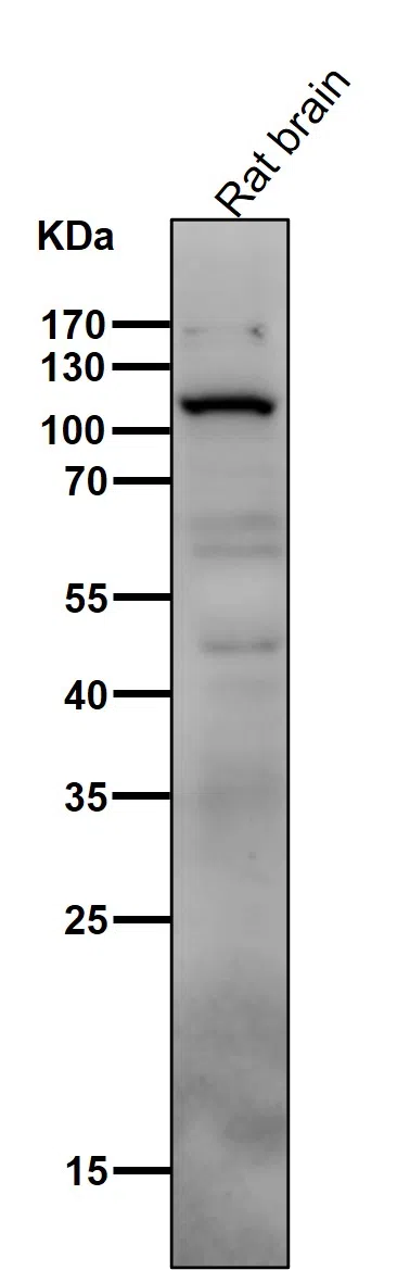 PI3 Kinase p110 delta Rabbit Monoclonal Antibody - Size: 100µl