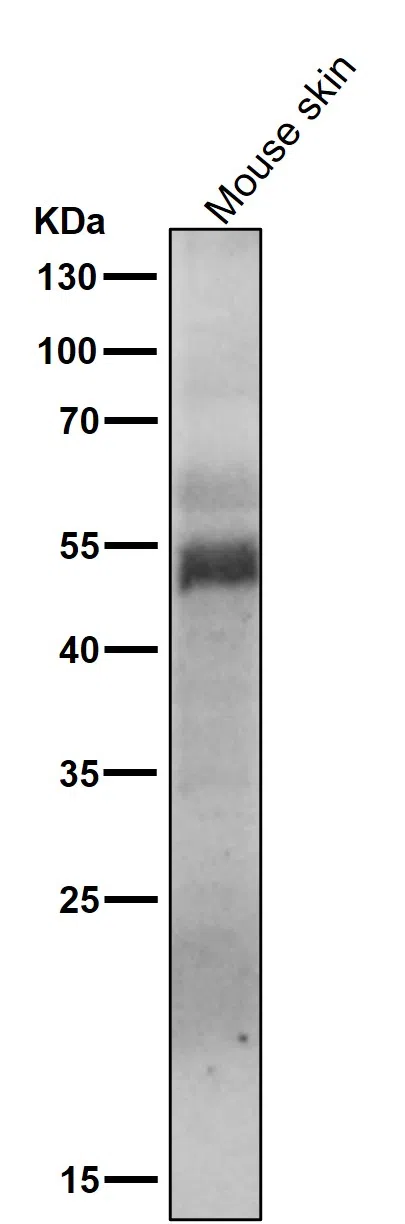 Phospho-MLKL(S358) Rabbit Monoclonal Antibody - Size: 100µl