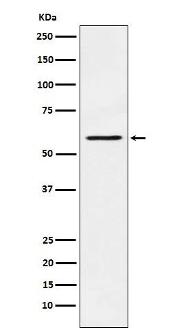 PAK1 Rabbit Monoclonal Antibody - Size: 100µl