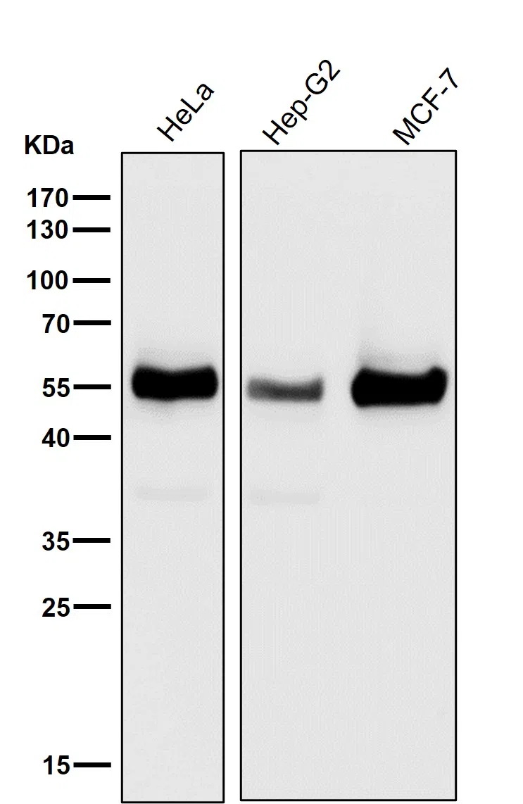 TXNIP Rabbit Monoclonal Antibody - Size: 100µl