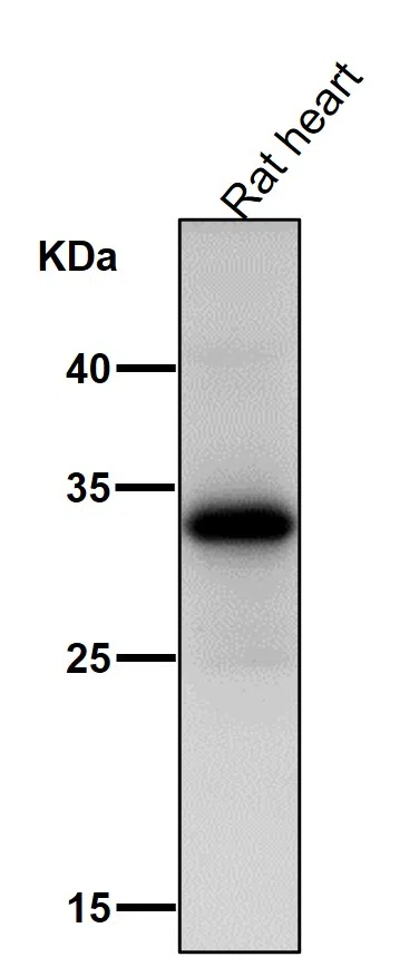 UCP1+UCP3 Rabbit Monoclonal Antibody