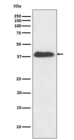 Anti-XLF Rabbit Monoclonal Antibody - Size: 100µl