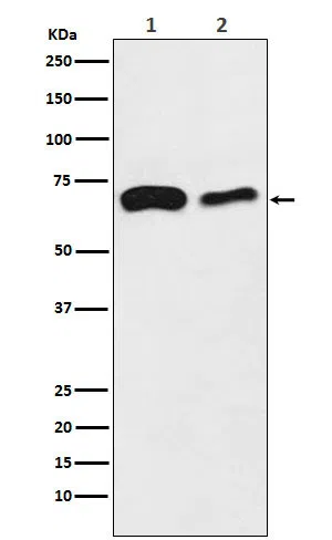 SLC27A4/FATP4 Rabbit Monoclonal Antibody - Size: 100µl