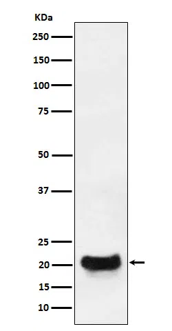 DCTN5 Rabbit Monoclonal Antibody - Size: 50µl