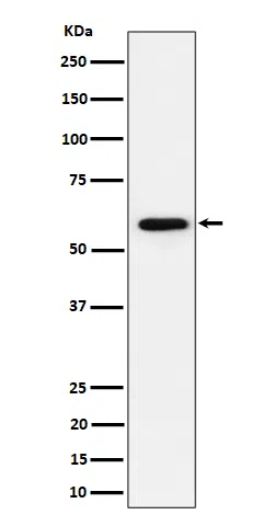 PRPF31 Rabbit Monoclonal Antibody - Size: 50µl