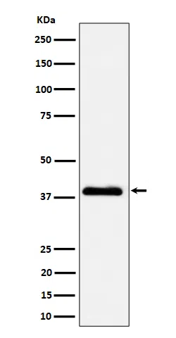 NSDHL Rabbit Monoclonal Antibody - Size: 100µl