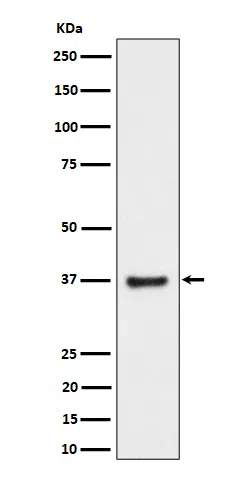 RNF115 Rabbit Monoclonal Antibody - Size: 50µl