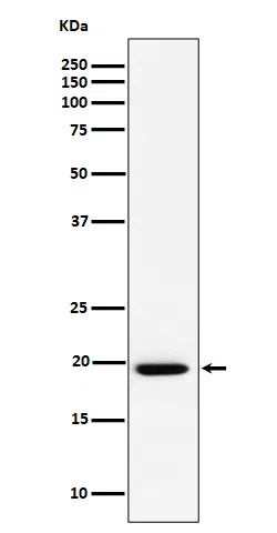 UFC1 Rabbit Monoclonal Antibody - Size: 100µl