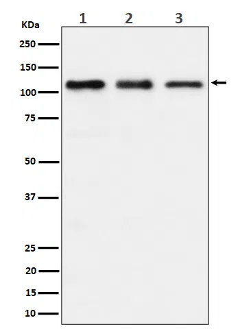 TAOK1 Rabbit Monoclonal Antibody - Size: 50µl