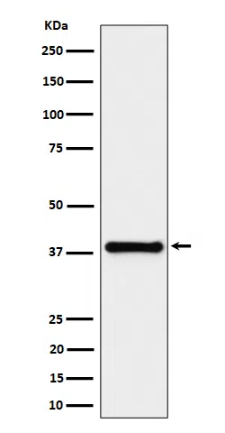 UCHL5IP Rabbit Monoclonal Antibody - Size: 50µl