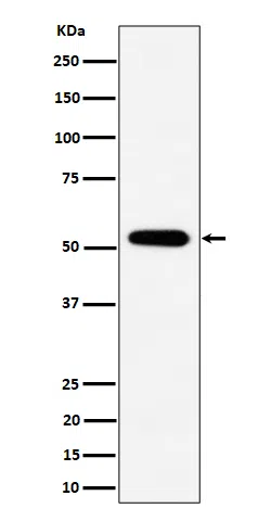 PPP2R5E Rabbit Monoclonal Antibody - Size: 50µl