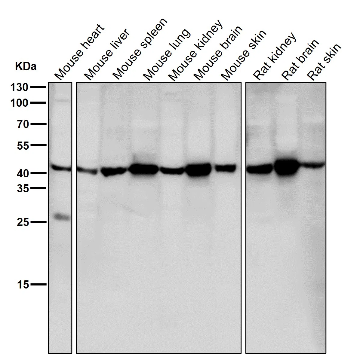 GNAQ Rabbit Monoclonal Antibody - Size: 50µl
