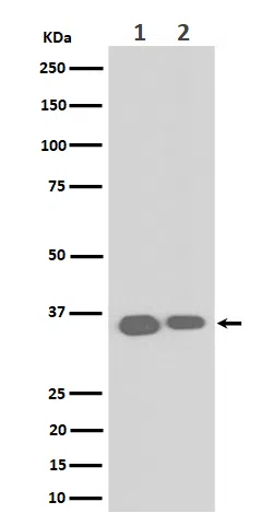 ELOVL5 Rabbit Monoclonal Antibody - Size: 50µl