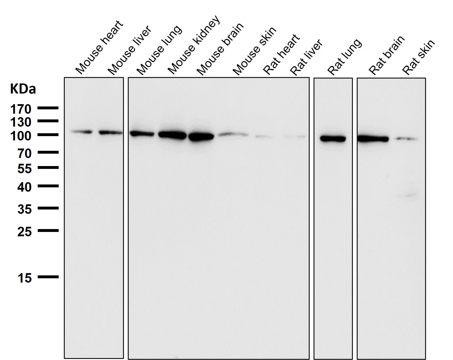 EXOC2 Rabbit Monoclonal Antibody - Size: 100µl