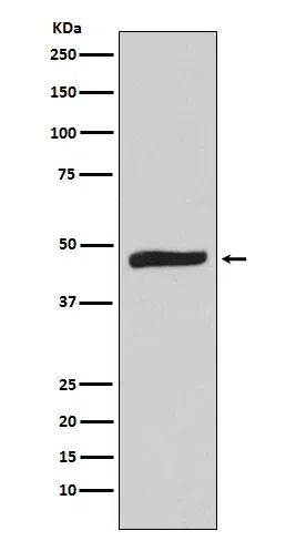 MAPKAP Kinase 2 Rabbit Monoclonal Antibody - Size: 50µl