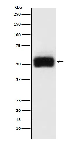 MMP17 Rabbit Monoclonal Antibody - Size: 50µl