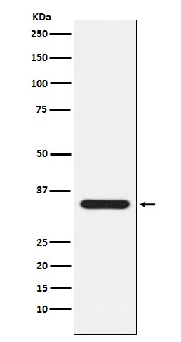 Presenilin 1 Rabbit Monoclonal Antibody - Size: 100µl
