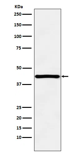 HOXA13 Rabbit Monoclonal Antibody - Size: 100µl