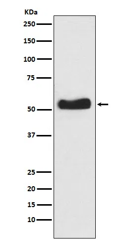 Glucokinase Rabbit Monoclonal Antibody - Size: 100µl