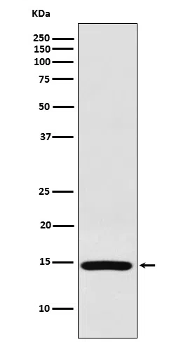 RPS19 Rabbit Monoclonal Antibody
