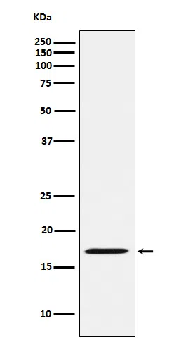 FHIT Rabbit Monoclonal Antibody - Size: 100µl