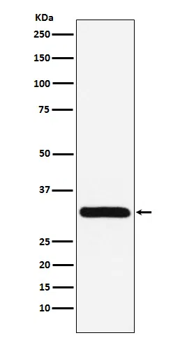 PSME1 Rabbit Monoclonal Antibody - Size: 50µl