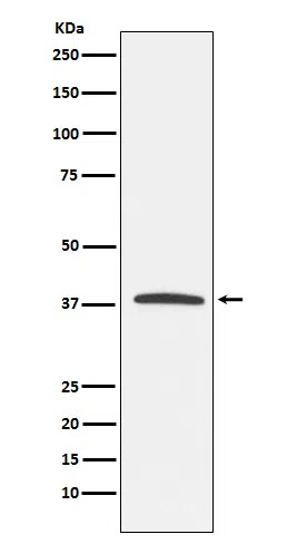 KLRG1 Rabbit Monoclonal Antibody - Size: 100µl