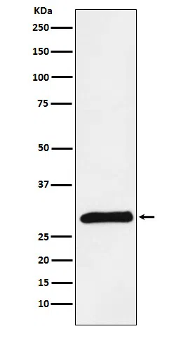PRSS2 Rabbit Monoclonal Antibody - Size: 100µl