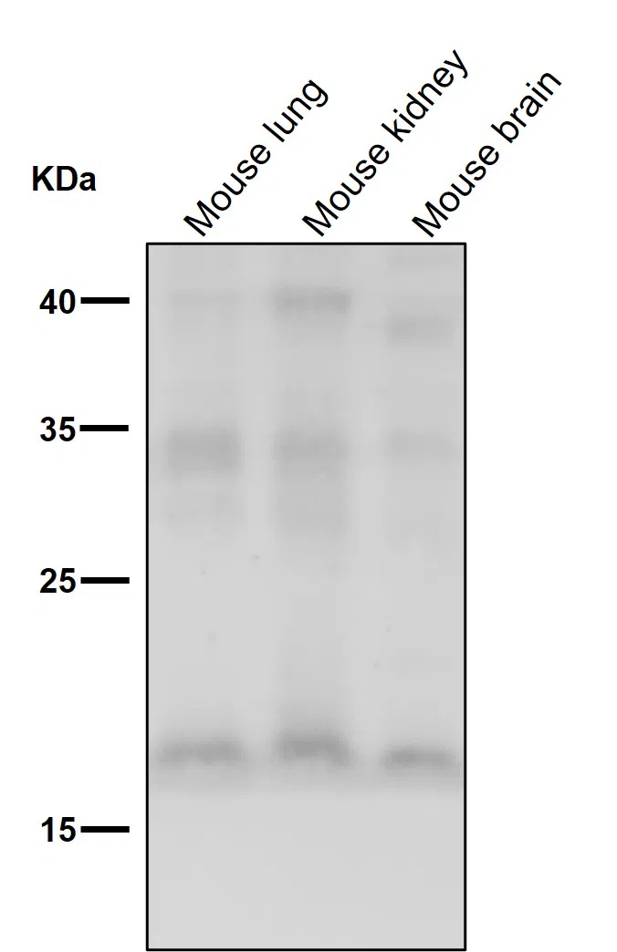 FGF1 Rabbit Monoclonal Antibody - Size: 50µl