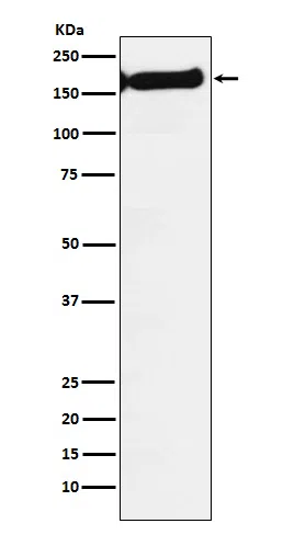SF3B1 Rabbit Monoclonal Antibody