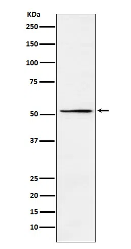 MEIS2 Rabbit Monoclonal Antibody - Size: 100µl