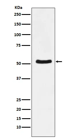 DDX6 Rabbit Monoclonal Antibody - Size: 50µl