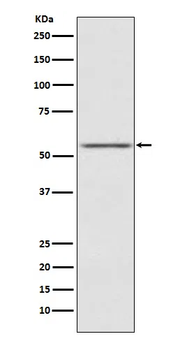 AMHR2 Rabbit Monoclonal Antibody - Size: 50µl