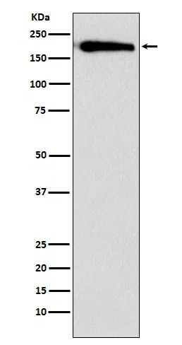 SMARCC1/BAF155 Rabbit Monoclonal Antibody