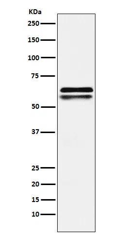 NAP1L1 Rabbit Monoclonal Antibody - Size: 50µl