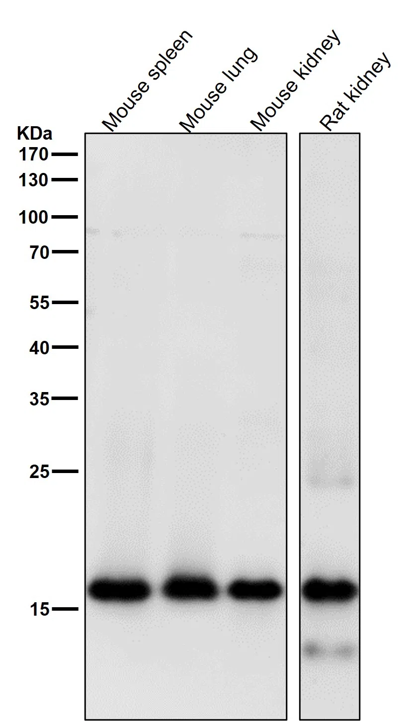 MYL9 Rabbit Monoclonal Antibody - Size: 100µl