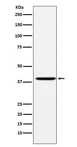 CAPG Rabbit Monoclonal Antibody - Size: 100µl