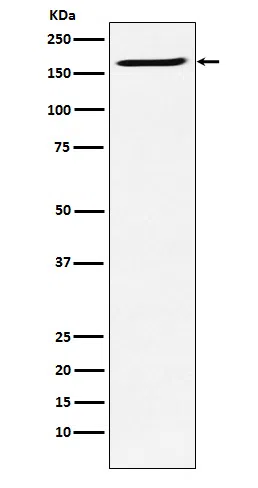 SMC4 Rabbit Monoclonal Antibody - Size: 50µl