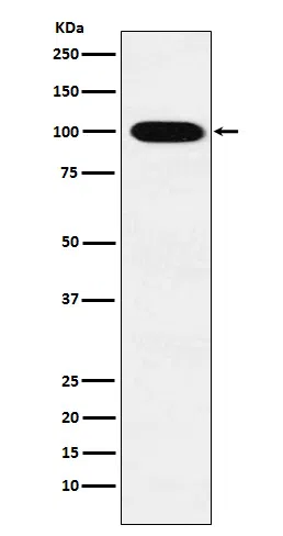 VPS18 Rabbit Monoclonal Antibody
