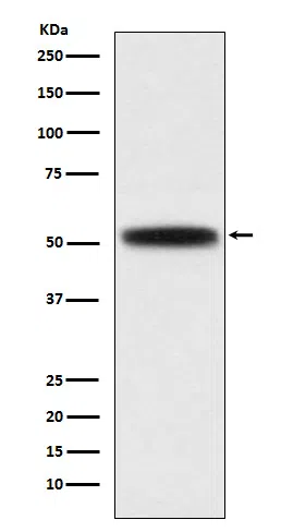 DGAT1 Rabbit Monoclonal Antibody - Size: 50µl
