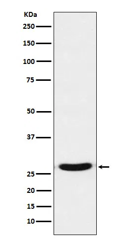 TCF21 Rabbit Monoclonal Antibody - Size: 100µl