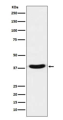 VPS26 Rabbit Monoclonal Antibody - Size: 100µl