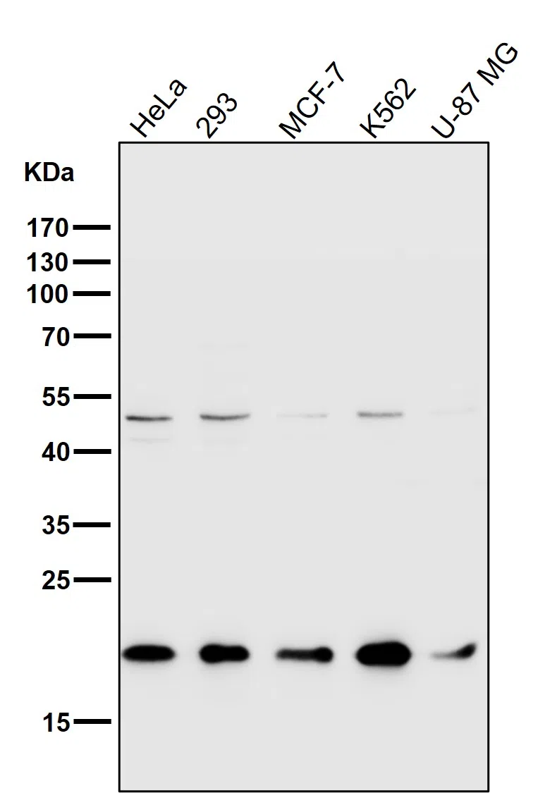TOMM22 Rabbit Monoclonal Antibody - Size: 100µl