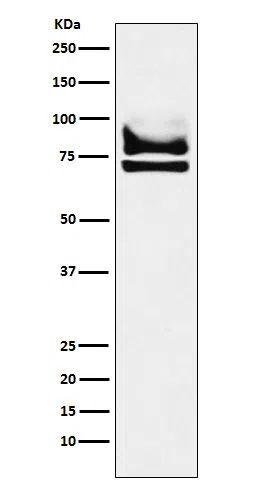 DDX17 Rabbit Monoclonal Antibody - Size: 50µl