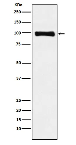 PIWIL1 Rabbit Monoclonal Antibody - Size: 50µl