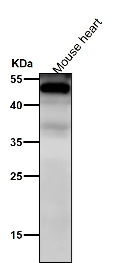NFIB/NF1B2 Rabbit Monoclonal Antibody - Size: 100µl
