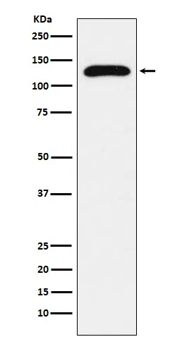 TRPC1 Rabbit Monoclonal Antibody - Size: 100µl