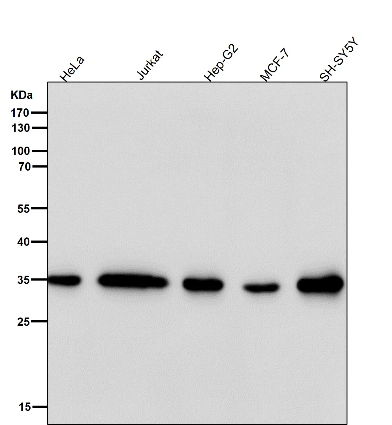 FRG1 Rabbit Monoclonal Antibody