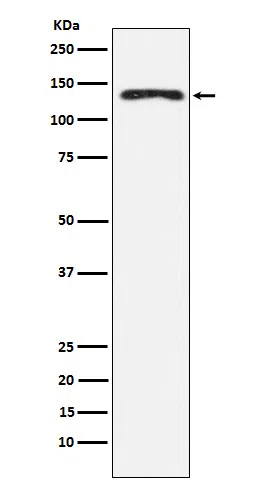 NEDD4 Rabbit Monoclonal Antibody - Size: 50µl