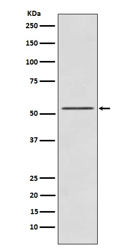 P70S6 Kinase beta Rabbit Monoclonal Antibody - Size: 50µl